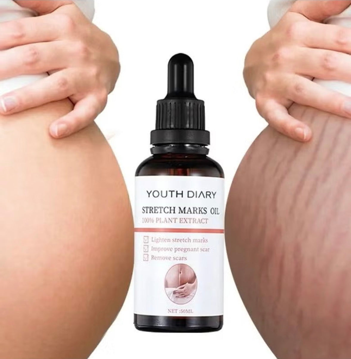 زيت ازالة علامة التمدد  YOUTH DIARY
